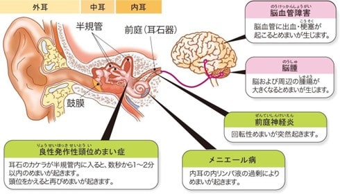 めまいを見分ける・治療する めまいを見分ける・治療する (ENT臨床フロンティア) | 内藤 泰